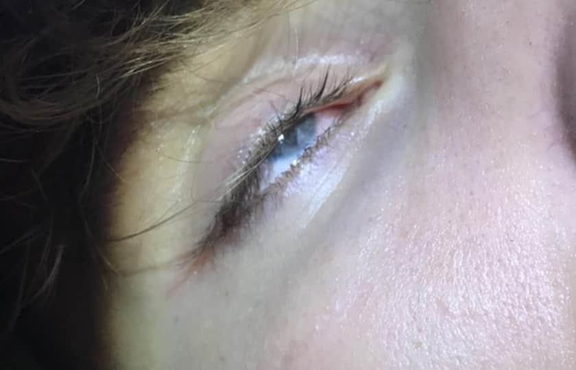 DeArmon CAST: Peter Pan The Musical